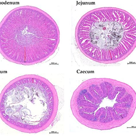 Image result for Duodenum vs Jejunum