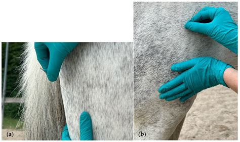 Short-Term Impact of Dry Needling Treatment for Myofascial Pain on ...
