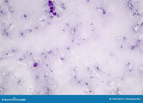 Sperm Or Semen Test Or Analysis Concept Photo. Doctor, Technician Or ...