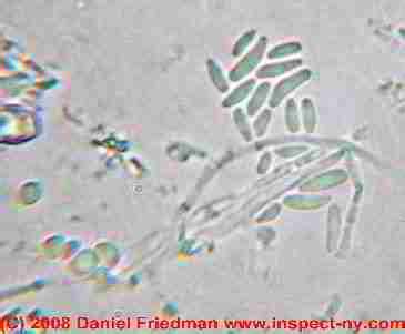 Mold Under Microscope 的图像结果