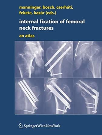 Buy Internal Fixation Of Femoral Neck Fractures An Atlas Book Online at ...