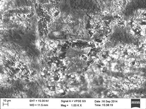 Fig. 5: It shows an SEM image of the dentinal tubules and smear layer ...