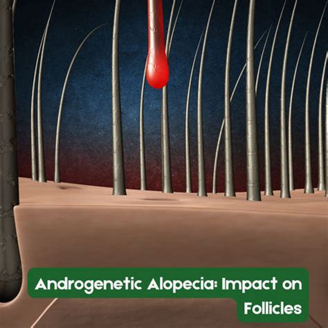 Hair Follicles: Functions, Structure, and Common Conditions | Clinikally