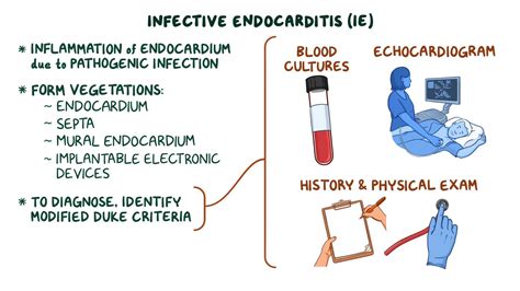 Infective Endocarditis Modified Duke Criteria Youtube Computed