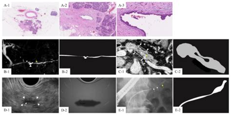 Pre-Operative Imaging and Pathological Diagnosis of Localized High ...