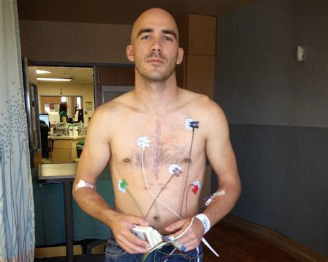 Chest Brace After Heart Surgery at Timothy Charles blog