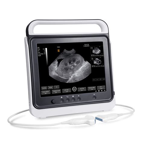 Portable Ultrasound Machine