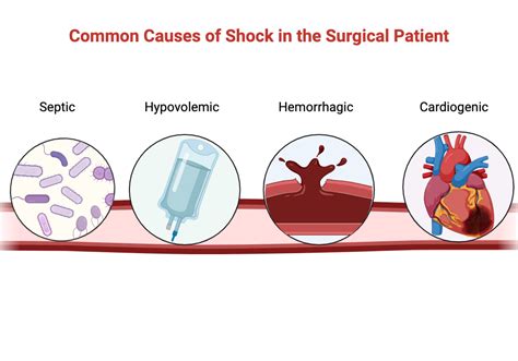 Shock 的图像结果
