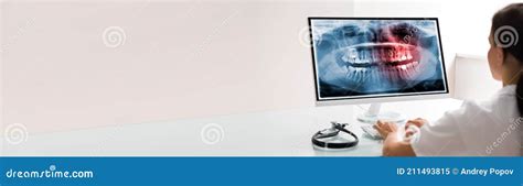 Image result for Dentists Using Computer