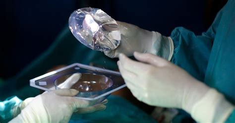 Brazilian Plastic Surgeon 'Dr Bumbum' Flees After Patient Succumbs To ...