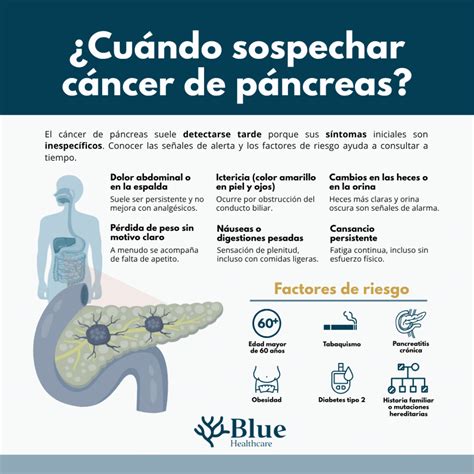 Ecoendoscopia: diagnóstico precoz del cáncer de páncreas