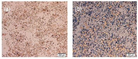 Conquering Cancer Multi-Drug Resistance Using Curcumin and Cisplatin ...