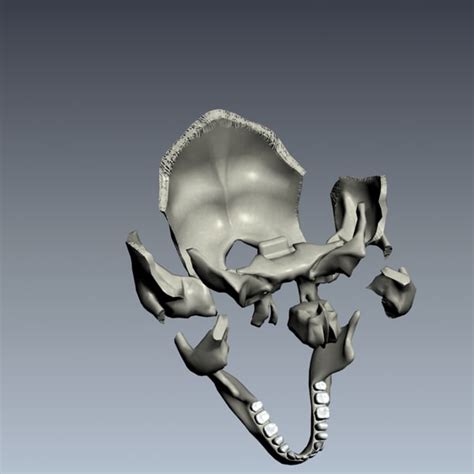 Image result for Exploding Skull