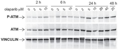 Cancer Cells Haploinsufficient for ATM Are Sensitized to PARP ...