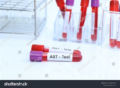 AST Blood Test 的图像结果
