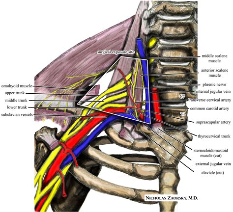 Thoracic outlet syndrome; Scalenus Anticus Syndrome; Costoclavicular ...