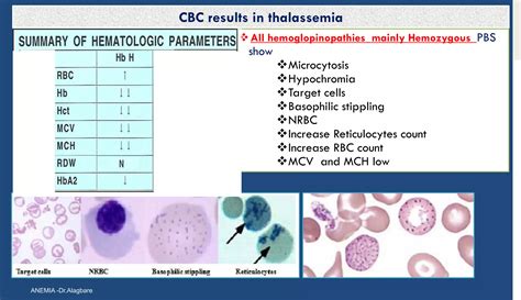 Alfa thalassemia syndromes | PDF