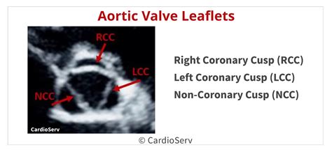 Back to the Basics: Aortic Valve Anatomy - Cardioserv - structure of leaflet