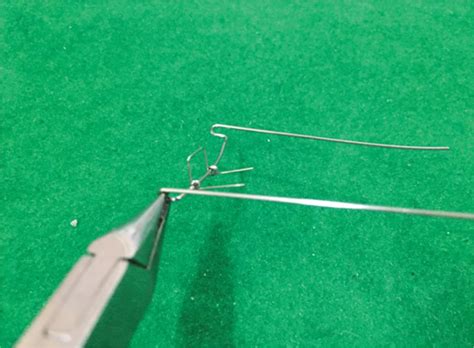 S-clasp with Apron Spring: A Single Tooth Crossbite Correction in ...