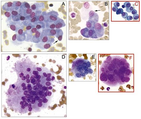 Development Of Osteoblasts And Osteoclasts From Bone