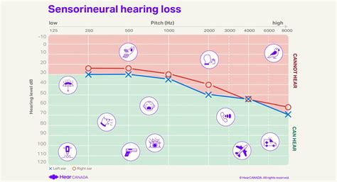 How To Read An Audiogram: Essential Types and Symbols