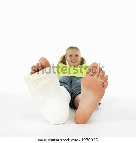 Girl With A Broken Leg (Close-Up Of Feet, One With A Plaster Bandage) Stock Photo 1970035 ...