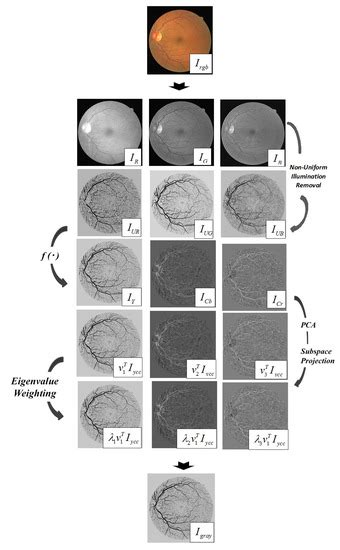 Impact of Retinal Vessel Image Coherence on Retinal Blood Vessel ...
