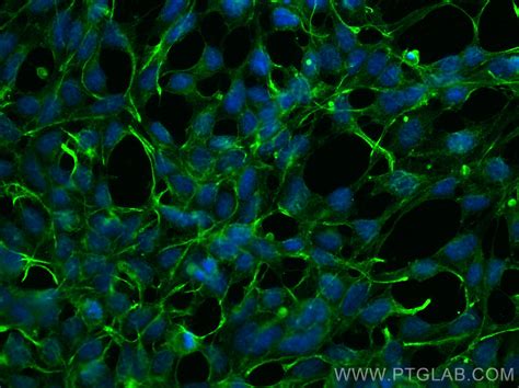pan Ras antibody (60309-1-Ig) | Proteintech