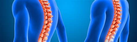 Spine Pro | Best Physiotherapy Clinic in Hyderabad