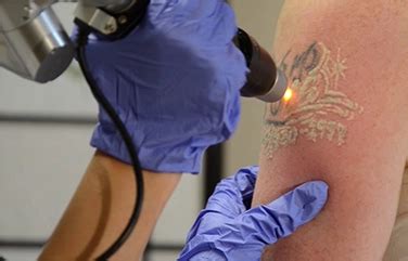 Bonitaa – Skin & Hair Care Clinic in Sengunthapuram, Karur