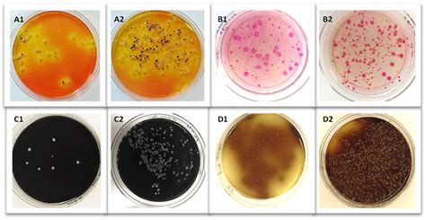 Gold Nanoparticle-Based Plasmonic Detection of Escherichia coli, Salmonella enterica ...