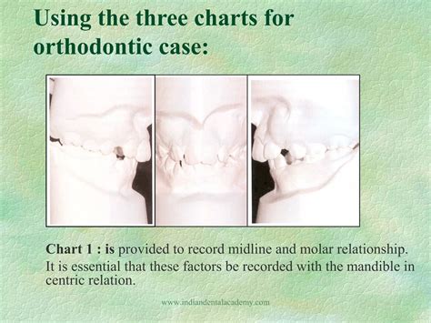Image result for Vto Core Target