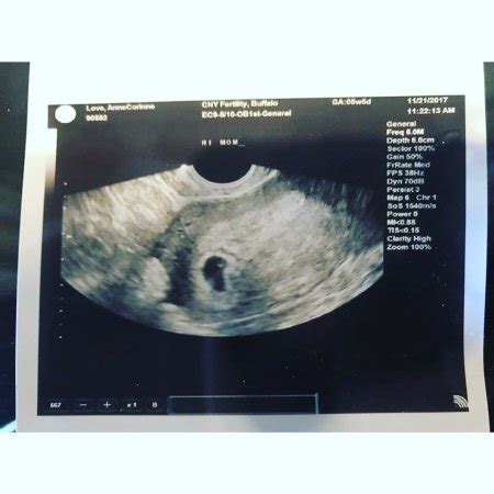 HCG 3000 nothing in ultrasound | BabyCenter