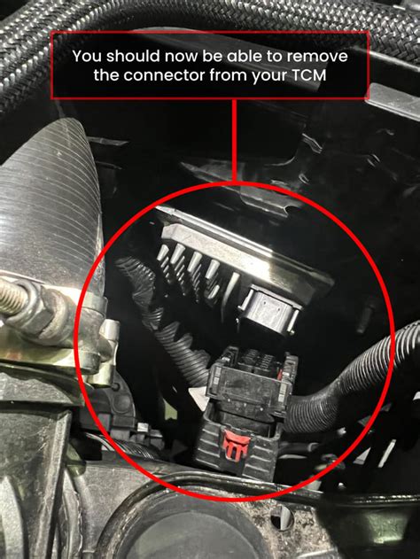 Image result for TCM Replacement