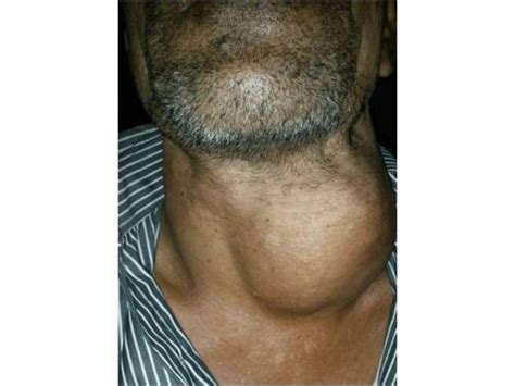 The Other Facilities available in the ENT department