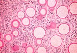 Image result for Trophocytes