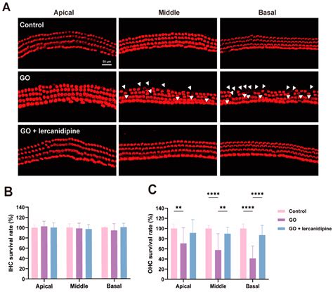 Lercanidipine’s Antioxidative Effect Prevents Noise-Induced Hearing Loss