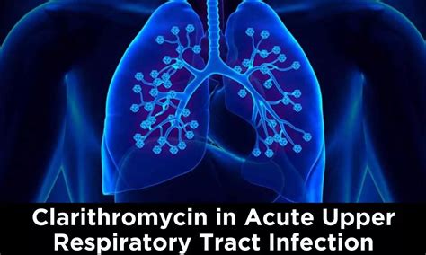 Approach to Treatment of Acute Upper Respiratory Tract Infections and ...