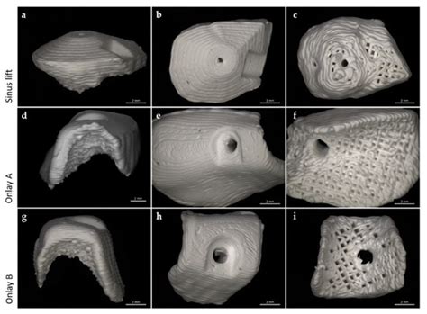 JCM | Special Issue : Digital Workflows and Material Sciences in Dental ...