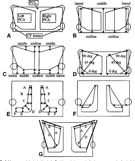 Figure 1 from Relationship of the Posterior Cricoarytenoid Muscle to ...