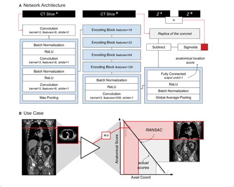 Image result for Define Localizer