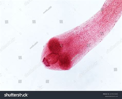 481 Tapeworm Scolex Images, Stock Photos & Vectors | Shutterstock