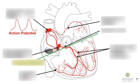 Image result for Cardiac Conduction System Disorders