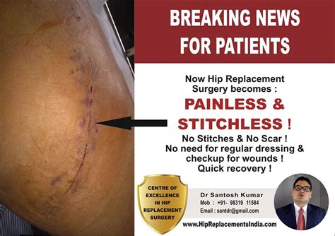 Dr. Santosh Kumar, Best Orthopedic Surgeon in Kolkata, India | Robotic ...