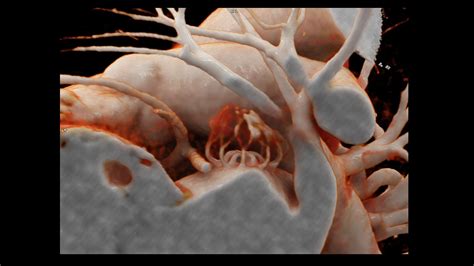 SOMATOM Pro.Pulse Dual Source CT scanner - Siemens Healthineers USA