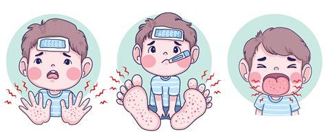 Hand Foot Mouth Disease For Pregnancy at Andrea Burnside blog