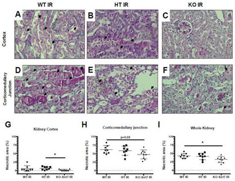 Sirtuin 7 Deficiency Reduces Inflammation and Tubular Damage Induced by ...
