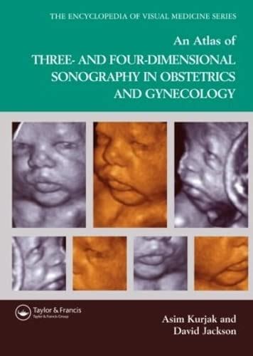 Buy AN ATLAS OF THREE AND FOUR DIMENSIONAL SONOGRAPHY IN OBSTETRICS AND ...