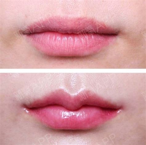 上嘴唇中间有个唇珠上嘴唇中间有个唇珠代表什么2022已更新今日图集