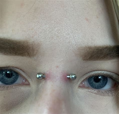 Eyebrow Piercing Infection Signs
